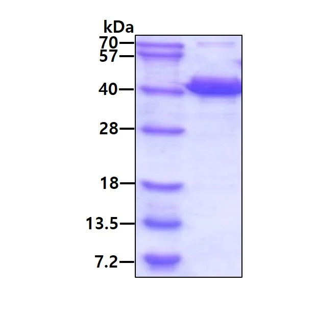 SDS-PAGE - Recombinant Human EB2 protein (His tag N-Terminus) (AB113592)