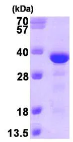 SDS-PAGE - Recombinant Human EB3 protein (His tag N-Terminus) (AB101197)
