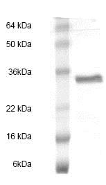Recombinant Human EBI3 protein
