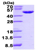 Recombinant Human EBP1 protein
