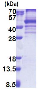 SDS-PAGE - Recombinant Human EBP2 protein (denatured) (His tag N-Terminus) (AB171692)
