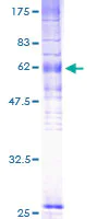 SDS-PAGE - Recombinant Human EBV Induced Gene 2/EBI2 protein (AB158331)