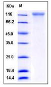 SDS-PAGE - Recombinant Human ECE1 protein (His tag) (AB276334)
