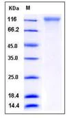 SDS-PAGE - Recombinant Human ECE1 protein (His tag) (AB276334)