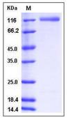 SDS-PAGE - Recombinant Human ECE2 protein (His tag) (AB276228), expandable thumbnail
