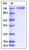 SDS-PAGE - Recombinant Human ECE2 protein (His tag) (AB276228)