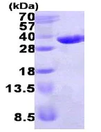 SDS-PAGE - Recombinant Human ECHDC1 protein (His tag N-Terminus) (AB123187)
