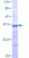 SDS-PAGE - Recombinant Human ECM protein (AB161476)