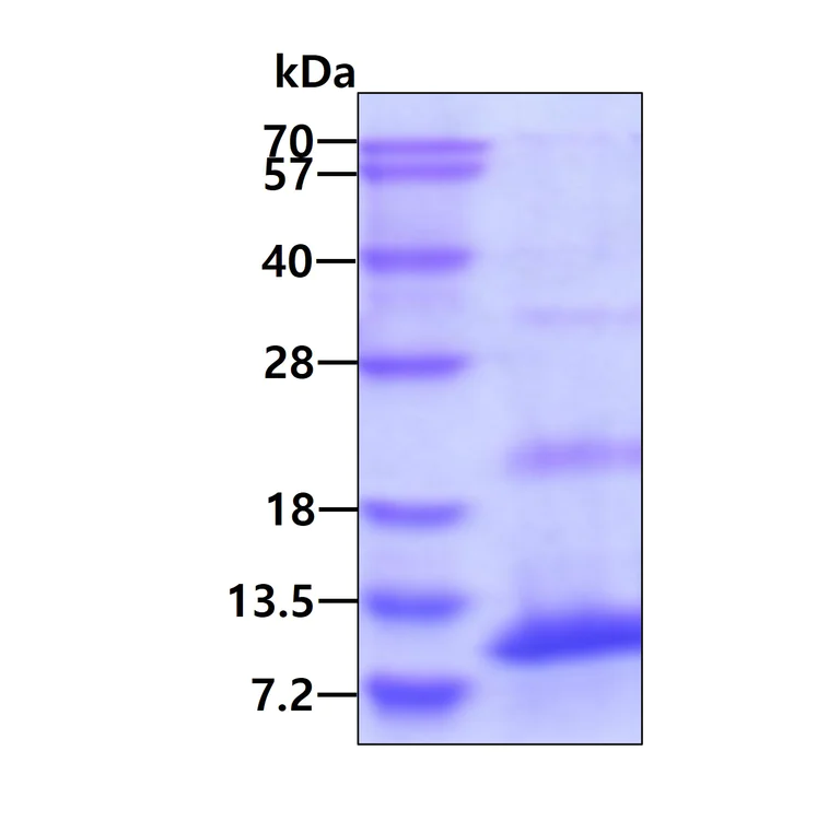 SDS-PAGE - Recombinant Human ECRG-2 protein (His tag N-Terminus) (AB167899)
