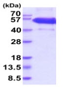 SDS-PAGE - Recombinant Human EDA2R/XEDAR protein (Fc tag C-Terminus + His tag C-Terminus) (AB219489)