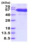 SDS-PAGE - Recombinant Human EDA2R/XEDAR protein (His tag) (AB219489)
