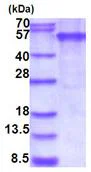 SDS-PAGE - Recombinant Human EDAR protein (denatured) (AB187467)