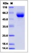SDS-PAGE - Recombinant Human EDEM2 protein (His tag) (AB276680)