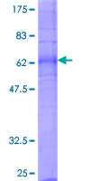 SDS-PAGE - Recombinant Human EDG2 /LPA-1 protein (GST tag N-Terminus) (AB152354)