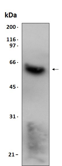 Western blot - Recombinant Human EDIL3/DEL1 protein (His tag) (AB204774), expandable thumbnail