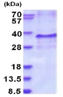 SDS-PAGE - Recombinant Human EDN3 protein (His tag N-Terminus) (AB202211)
