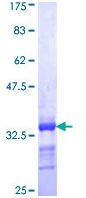 SDS-PAGE - Recombinant Human EEA1 protein (AB112379), expandable thumbnail