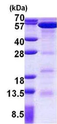 SDS-PAGE - Recombinant Human EED protein (His tag N-Terminus) (AB156723)