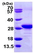 SDS-PAGE - Recombinant Human eEF1B2 protein (AB104894)