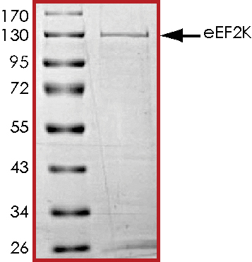 SDS-PAGE - Recombinant human EEF2K protein (AB84570), expandable thumbnail