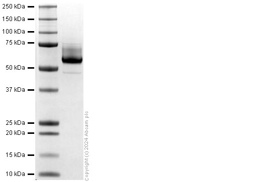 SDS-PAGE - Recombinant Human EFEMP1/Fibulin-3 protein (His tag) (AB318255), expandable thumbnail