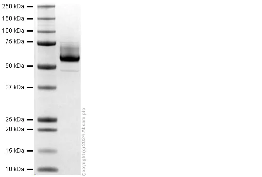 SDS-PAGE - Recombinant Human EFEMP1/Fibulin-3 protein (His tag) (AB318255)