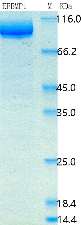 SDS-PAGE - Recombinant Human EFEMP1 Protein Standard (His tag) (AB316445)