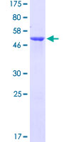 Recombinant Human EFHD2/SWS1 protein