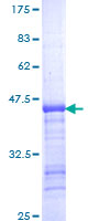 SDS-PAGE - Recombinant Human Eg5 protein (AB152491)