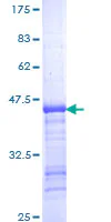 SDS-PAGE - Recombinant Human Eg5 protein (GST tag N-Terminus) (AB152491)