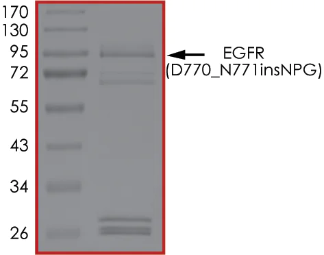 SDS-PAGE - Recombinant human EGFR (D770_N771insNPG) protein (Active) (AB268479)