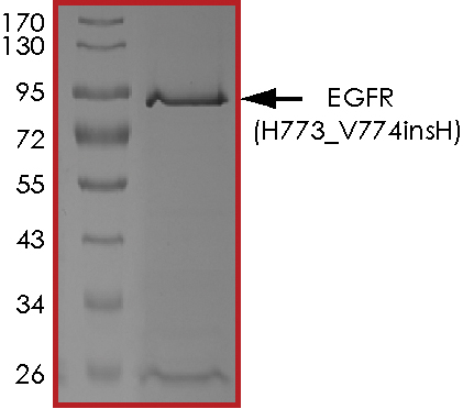 Recombinant human EGFR (H773_V774insH) protein