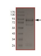 SDS-PAGE - Recombinant human EGFR (mutated C797S) protein (AB208478), expandable thumbnail