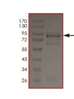 SDS-PAGE - Recombinant human EGFR (mutated C797S) protein (AB208478)