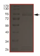 SDS-PAGE - Recombinant human EGFR (mutated G719S) protein (AB190393)
