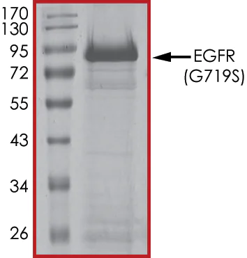 SDS-PAGE - Recombinant human EGFR (mutated G719S) protein (AB190393)