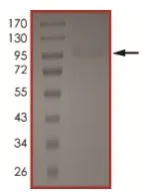SDS-PAGE - Recombinant human EGFR (mutated T790M + C797S + L858R) protein (Active) (AB223159)