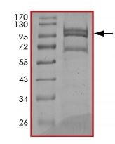 SDS-PAGE - Recombinant human EGFR protein (Mutant) (AB208473), expandable thumbnail