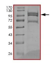 SDS-PAGE - Recombinant human EGFR protein (Mutant) (AB208473)
