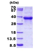 SDS-PAGE - Recombinant Human EHF protein (His tag) (AB264454)