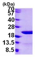 SDS-PAGE - Recombinant Human EIF1AY protein (AB103788)
