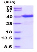 SDS-PAGE - Recombinant Human eIF2A protein (AB95932)