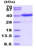 SDS-PAGE - Recombinant Human eIF2A protein (His tag N-Terminus) (AB95932)