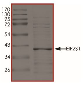 SDS-PAGE - Recombinant human EIF2S1 protein (His tag) (AB268521)