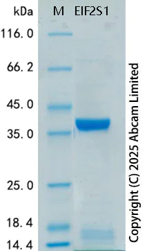SDS-PAGE - Recombinant Human EIF2S1 Protein Standard (His tag) (AB323067)