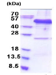 SDS-PAGE - Recombinant Human EIF3F protein (denatured) (His tag N-Terminus) (AB171467)