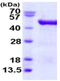 SDS-PAGE - Recombinant Human eIF4A3 protein (His tag N-Terminus) (AB123151)