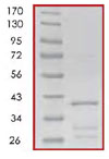 Recombinant Human eIF4EBP1 protein (Tagged)