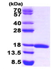 SDS-PAGE - Recombinant Human eIF5A protein (AB87457), expandable thumbnail