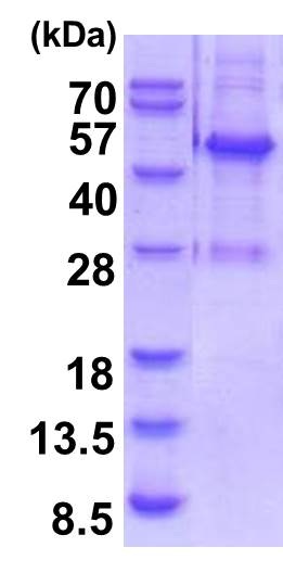 SDS-PAGE - Recombinant Human ELAC1 protein (AB201882), expandable thumbnail